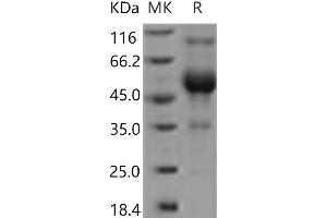 Western Blotting (WB) image for CD83 (CD83) protein (Fc Tag) (ABIN7321123) (CD83 Protein (CD83) (Fc Tag))
