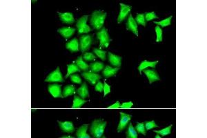 Immunofluorescence analysis of HeLa cells using MSRB1 Polyclonal Antibody (MSRB1 抗体)