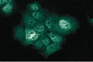 Immunofluorescent staining of MCF7 cells with anti-XIAP/hILP antibody. (XIAP 抗体  (AA 268-426))