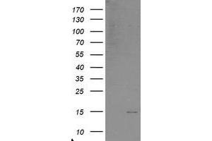 Western Blotting (WB) image for anti-Chromosome 17 Open Reading Frame 37 (C17orf37) antibody (ABIN1501777) (C17orf37 抗体)