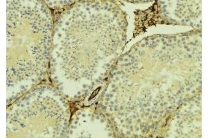 ABIN6275107 at 1/100 staining Mouse testis tissue by IHC-P. (ELOVL5 抗体  (C-Term))