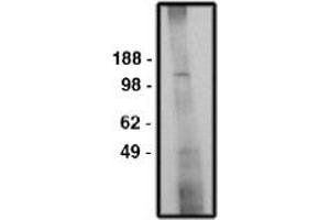 Image no. 1 for anti-Solute Carrier Family 9 (Sodium/hydrogen Exchanger), Member 6 (SLC9A6) antibody (ABIN265251) (SLC9A6 抗体)