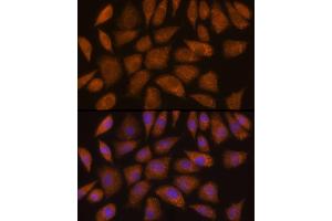 Immunofluorescence analysis of L929 cells using GCLC Rabbit pAb (ABIN6130444, ABIN6141016, ABIN6141017 and ABIN6214615) at dilution of 1:100 (40x lens). (GCLC 抗体  (AA 1-252))