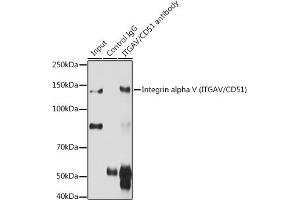 Immunoprecipitation analysis of 200 μg extracts of C6 cells using 3 μg Integrin alpha V (ITGAV/CD51) antibody (ABIN3022887, ABIN3022888, ABIN3022889 and ABIN6219281). (CD51 抗体  (C-Term))