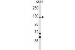 Western Blotting (WB) image for anti-MCF.2 Cell Line Derived Transforming Sequence (MCF2) antibody (ABIN2996823) (MCF2 抗体)
