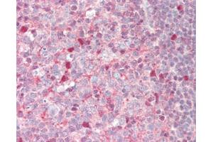 Human Tonsil: Formalin-Fixed, Paraffin-Embedded (FFPE)