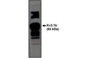 Image no. 1 for anti-Potassium Voltage-Gated Channel, Shaw-Related Subfamily, Member 1 (KCNC1) antibody (ABIN265028) (KCNC1 抗体)
