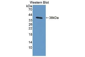 Western Blotting (WB) image for anti-Actin Related Protein 2/3 Complex, Subunit 2, 34kDa (ARPC2) (AA 1-300) antibody (ABIN7441580)