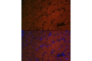 Immunofluorescence analysis of mouse brain using CNPase Rabbit mAb (ABIN7265322) at dilution of 1:100 (40x lens). (Cnpase 抗体)
