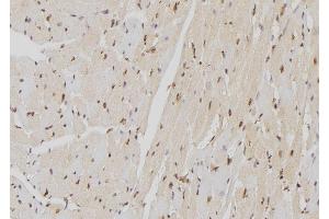 ABIN6262924 and ABIN6277599 at 1/100 staining Mouse heart tissue by IHC-P. (Lamin B Receptor 抗体  (Internal Region))