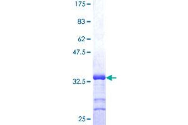 MT3 Protein (AA 1-68) (GST tag)