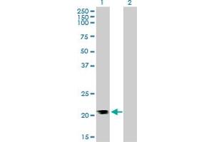 Western Blot analysis of RHOA expression in transfected 293T cell line by RHOA monoclonal antibody (M05), clone 1C1. (RHOA 抗体  (AA 1-193))