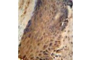 Immunohistochemistry analysis in formalin fixed and paraffin embedded human skin reacted with GFPT2 / GFAT2 Antibody (Center) followed which was peroxidase conjugated to the secondary antibody and followed by DAB staining. (GFPT2 抗体  (Middle Region))