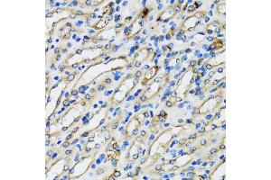 Immunohistochemistry of paraffin-embedded mouse kidney using COPB2 antibody. (COPB2 抗体)