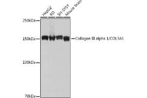 Western blot analysis of extracts of various cell lines, using Collagen III alpha 1/COL3 antibody (ABIN7266459) at 1:1000 dilution. (COL3 抗体)