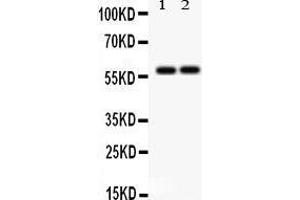 Anti-SCARB1 Picoband antibody, Western blotting All lanes: Anti SCARB1  at 0. (SCARB1 抗体  (C-Term))