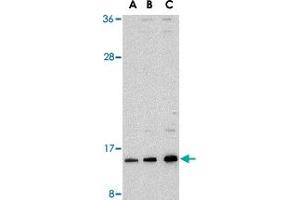 Western blot analysis of SUMO1 in HL-60 cell lysate with SUMO1 polyclonal antibody  at (A) 0. (SUMO1 抗体  (N-Term))