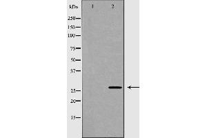 Western blot analysis of Hela whole cell lysates, using HSD17B10 Antibody. (HSD17B10 抗体  (Internal Region))