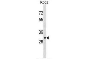 SULT1A2 Antibody (C-term) western blot analysis in K562 cell line lysates (35µg/lane).