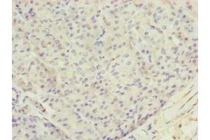 Immunohistochemistry of paraffin-embedded human pancreatic tissue using ABIN7173719 at dilution of 1:100 (TTLL7 抗体  (AA 1-260))