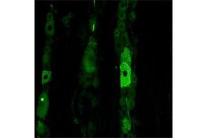IF on rat trigeminal using Mouse monoclonal antibody to rat p75NTR (ABIN350707) at a concentration of 10 µg/ml. (NGFR 抗体)