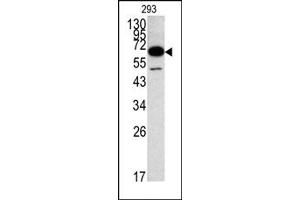Image no. 1 for anti-Methionyl Aminopeptidase 2 (METAP2) (N-Term) antibody (ABIN357679) (METAP2 抗体  (N-Term))