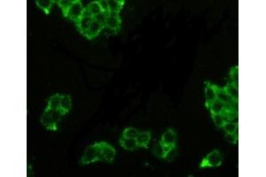 Detection of PAP in MCF7 cells using Polyclonal Antibody to Prostatic Acid Phosphatase (PAP) (ACPP 抗体  (AA 217-386))