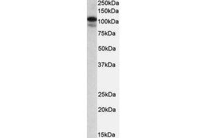 Western Blotting (WB) image for anti-SATB Homeobox 1 (SATB1) (AA 668-681) antibody (ABIN1493900) (SATB1 抗体  (AA 668-681))