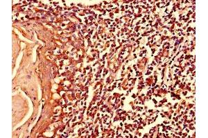 Immunohistochemistry of paraffin-embedded human tonsil tissue using ABIN7174965 at dilution of 1:100 (Myosin X 抗体  (AA 1-97))