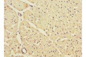 Immunohistochemistry (IHC) image for anti-Potassium Inwardly-Rectifying Channel, Subfamily J, Member 4 (KCNJ4) (AA 316-445) antibody (ABIN7157020)