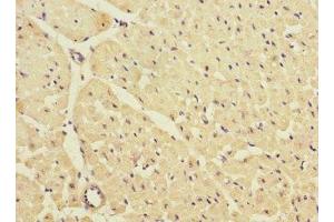 Immunohistochemistry of paraffin-embedded human heart tissue using ABIN7157020 at dilution of 1:100 (KCNJ4 抗体  (AA 316-445))