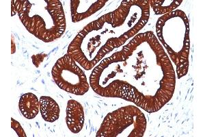Formalin-fixed, paraffin-embedded human Colon stained with Cytokeratin 19 Mouse Monoclonal Antibody (BA17) (Cytokeratin 19 抗体)