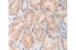 Immunohistochemistry (IHC) image for anti-Asparaginyl-tRNA Synthetase (NARS) (AA 1-330) antibody (ABIN5013163)