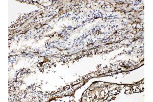 IHC analysis of Hemoglobin using anti- Hemoglobin antibody . (Hemoglobin Alpha 1 + 2 (HBA1,HBA2) (AA 2-142) 抗体)