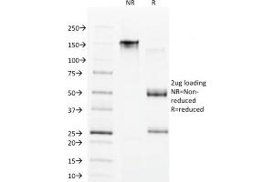 SDS-PAGE Analysis Purified CDX1 Mouse Monoclonal Antibody (CDX1/1650). (CDX1 抗体)