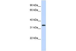WB Suggested Anti-FLJ23356 Antibody Titration:  0. (SGK196 抗体  (N-Term))