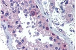 Human Testis (formalin-fixed, paraffin-embedded) stained with RHOXF2 antibody ABIN462204 followed by biotinylated goat anti-rabbit IgG secondary antibody ABIN481713, alkaline phosphatase-streptavidin and chromogen. (RHOXF2 抗体  (AA 108-157))