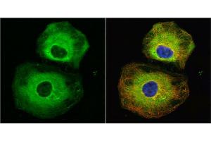 Immunofluorescence (IF) image for anti-Stathmin 1 (STMN1) (C-Term) antibody (ABIN2855912)