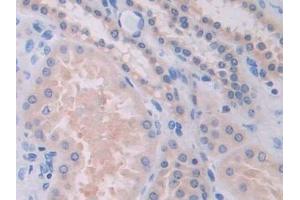 Immunohistochemistry (IHC) image for anti-Sulfatase Modifying Factor 1 (SUMF1) (AA 113-356) antibody (ABIN7435211)