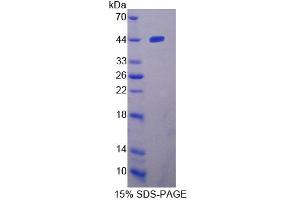 SDS-PAGE analysis of Human WARS2 Protein. (WARS2 蛋白)