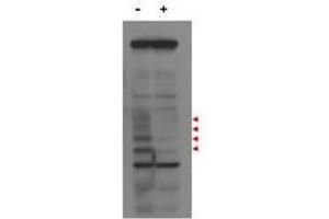 Western blot using  affinity purified anti-MLF1IP antibody shows detection of endogenous MLF1IP protein (a tier of four modified protein bands indicated by the arrowheads) in lysates of Hela cells treated with control luciferase shRNA (lane 1), and detection of MLF1IP in Hela cells transfected with MLF1IP (lane 3).