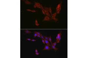 Immunofluorescence (IF) image for anti-Eukaryotic Translation Initiation Factor 4E Nuclear Import Factor 1 (EIF4ENIF1) (AA 150-250) antibody (ABIN7267051)