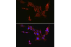 Immunofluorescence analysis of PC-12 cells using EIF4ENIF1 Rabbit pAb (ABIN7267051) at dilution of 1:100 (40x lens). (EIF4ENIF1 抗体  (AA 150-250))