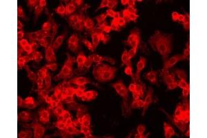 Image no. 9 for anti-Hypoxia Inducible Factor 1, alpha Subunit (Basic Helix-Loop-Helix Transcription Factor) (HIF1A) (AA 329-530) antibody (ABIN363210)