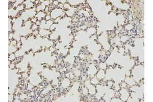 Immunohistochemistry (IHC) image for anti-4-Aminobutyrate Aminotransferase (ABAT) antibody (ABIN1876487) (ABAT 抗体)