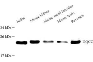 Western blot analysis of UQCC (ABIN7076094) at dilution of 1: 500 (Ubiquinol-Cytochrome C Reductase Complex Chaperone (UQCC) 抗体)