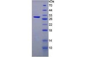 SDS-PAGE analysis of Mouse ITLN1 Protein. (ITLN1/Omentin 蛋白)
