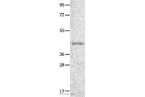 Western blot analysis of 231 cell  , using NTSR1 Polyclonal Antibody at dilution of 1:800 (NTSR1 抗体)