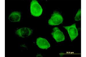 Immunofluorescence of monoclonal antibody to KRT18 on HeLa cell. (Cytokeratin 18 抗体  (AA 1-430))