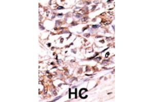 Immunohistochemistry (IHC) image for anti-DUSP13-M1 antibody (ABIN3003768) (DUSP13-M1 抗体)